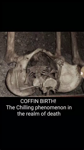 Macabre Knowledge on Instagram: "In 2010, archaeologists working near what is now northern Italy uncovered a medieval grave unlike anything they expected. Inside the burial lay the remains of a woman, and beneath her—positioned between her pelvic bones—were the bones of a developing fetus. Researchers from the University of Bologna and the University of Ferrara studied the remains and found evidence of a rare phenomenon known in forensic medicine as post-mortem fetal extrusion, sometimes informa