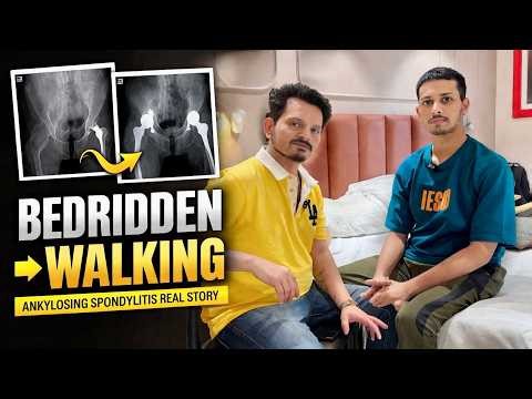 Ankylosing Spondylitis Real Story | Hip Replacement | Bedridden to Walking