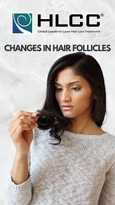 When Hair Follicles Change: . . . #HairLossAwareness #hairstyle #shampoo #hairloss #conditioner #hairtransplant #hairtransplantation #hair #trichologist #trichology #alopecia | United States Trichology Institute