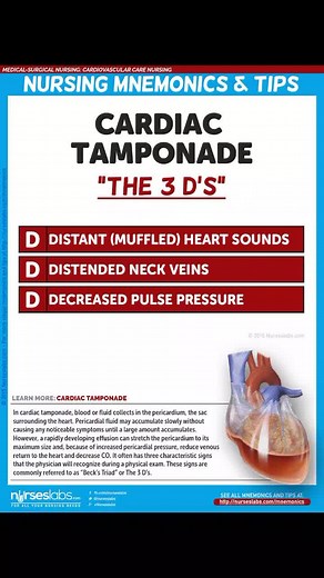 Essential Nursing Mnemonics for Myocardial Infarction