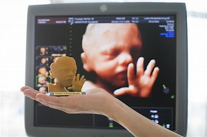 New full-color ultrasound #3DPrinting