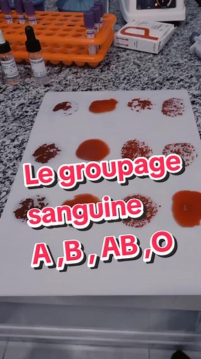 Test de groupage sanguin : procédure et importance des résultats