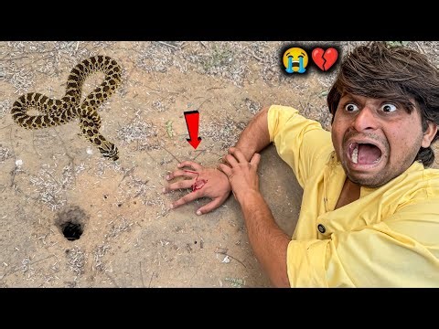 Snake Bites Raveriya Bhai 💔 ??