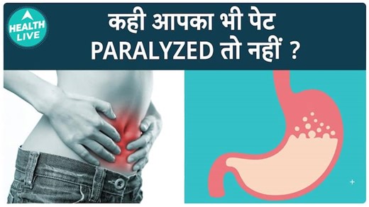 Experiencing Stomach Paralysis? Understanding Symptoms And Treatment Options | Health Live