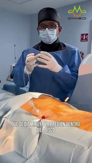 PLDD Surgery Laser Treatment with Harlas - Percutaneous Laser Disc Decompression