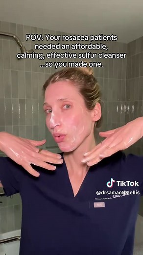 Sulfur Cleanser: The Unsung Hero for Rosacea Relief