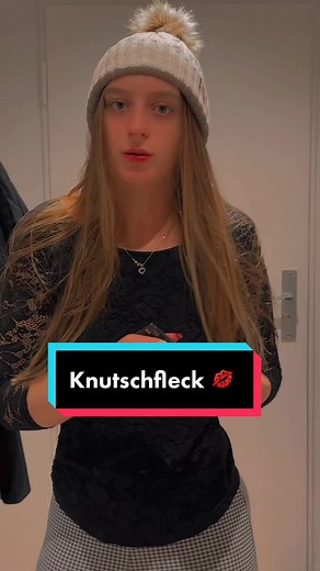 Knutschflecken: Ja oder Nein für die Beziehung?