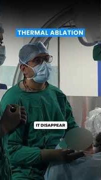 Her Journey Was Not Easy But Gracious | Thyroid Goiter Treatment Without Surgery