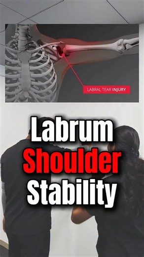 Flexifyme Physiotherapy & Pain Management on Instagram: "Struggling with shoulder pain or recovering from an injury? These shoulder labrum exercises are designed to improve shoulder stability workout and build lasting strength. By focusing on rotator cuff strengthening, you can speed up your shoulder injury rehab and support safe labrum tear recovery. With the right guidance, physiotherapy shoulder rehab becomes more effective through shoulder stabilization drills and progressive shoulder streng