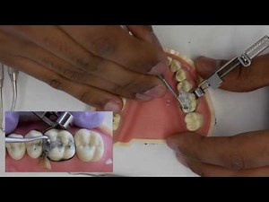 Amalgam Fill Restoration Walkthrough (tutorial) - Simulation Clinic Demonstration