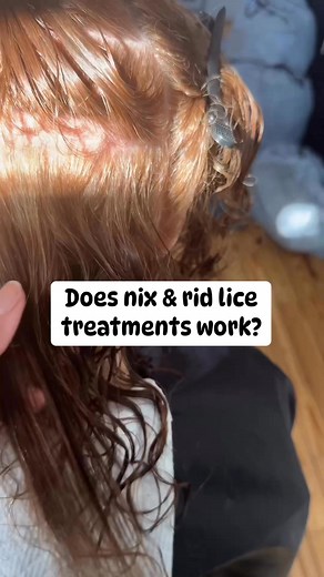 10K views · 18 reactions | Does over the counter lice treatments...