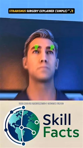 NeuroShotX on Instagram: "Strabismus Surgery Explained (Simple)”"