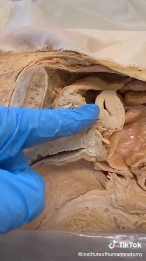 The Dangers of Holding In Urine: Bladder Explosion Explained