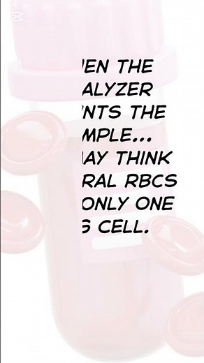 Cold Agglutinins Causing False CBC Results | Lab Insight #shorts