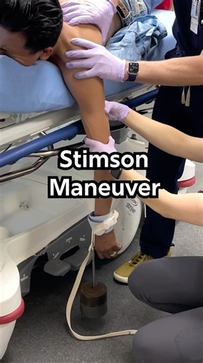 EM:RAP | 📽️ Watch our Stimson Technique Procedure Video! Ever dealt with a stubborn dislocated shoulder? Check out our own Dr. Jess Mason, as she... | Instagram