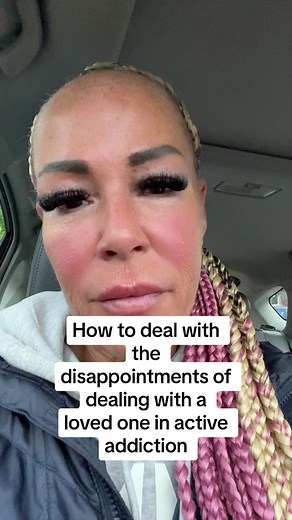 Loving someone in active addiction can be profoundly challenging, often accompanied by a rollercoaster of disappointments. Witnessing a person you care about succumb to the destructive grip of substances can evoke a range of emotions—frustration, sadness, and helplessness. It's crucial to recognize that their actions are driven by the powerful force of addiction, not a lack of love or consideration for those around them. The disappointments may manifest in broken promises, unreliability, and the