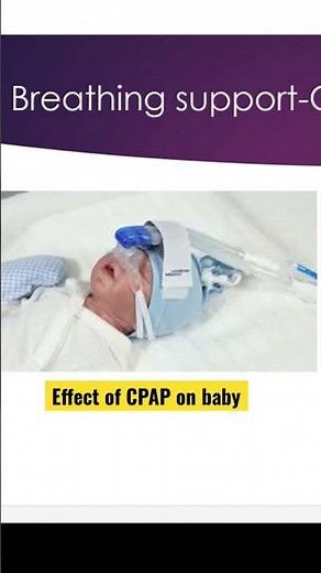 Effect of CPAP on baby-nasal injury #nicu #neonatal #neonatology #ventilation #cpap #NCPAP