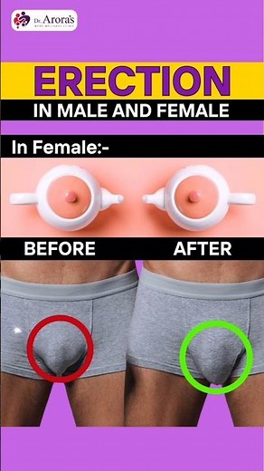 How a Female Erection Works | Male Vs Female Erection | Dr Deepak Aroras #viral #shortsvideo #shorts