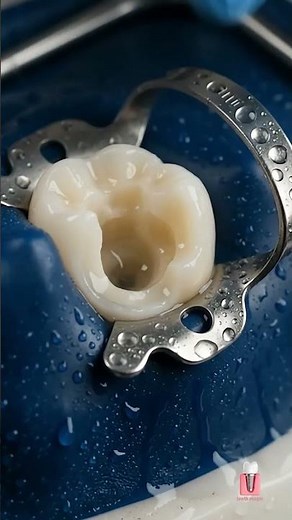 Satisfying 3D Tooth Repair & Restoration | Dental ASMR