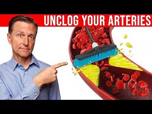 The #1 Best Remedy to Clean Plaque From Your Arteries - Dr. Eric Berg DC | AP News Himachal