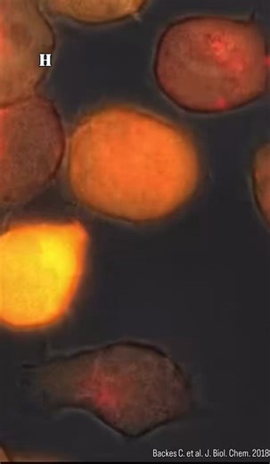 $IBRX is down today, but the biology behind NK cell therapy is still the same and still compelling.What’s happening here is NK cell–mediated serial killing. NK cells don’t need prior activation. They continuously scan, recognize abnormal tumor cells, and form an immunological synapse.Then the mechanism is very direct:• Perforin creates pores in the target cell membrane• Granzymes enter and trigger apoptosisOne target is cleared, and the NK cell moves on repeating the process.Tumors adapt by redu
