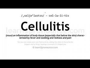 Pronunciation of Cellulitis | Definition of Cellulitis