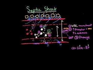 Septic Shock: Pathophysiology and Symptoms
