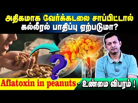 அதிகமாக வேர்க்கடலை சாப்பிட்டால் கல்லீரல் பாதிப்பு ஏற்படுமா? | Aflatoxin in peanuts - உண்மை விபரம்!