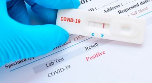 COVID-19: ¿Por qué una prueba puede ser falso positivo?