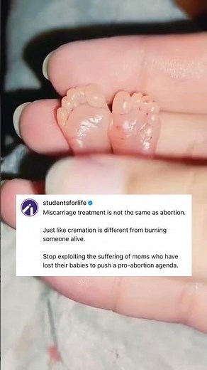 The Pro-Abortion Movement Is LYING About Miscarriage