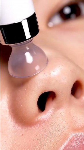“Nonstop Blackhead Suction — Oddly Satisfying!”