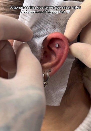 ✨Hoy vamos a hablar sobre el piercing flat✨🧚Está perfo es una de mis preferidas sin duda. Se pueden lucir infinita cantidad de piezas, es sumamente elegante, y me parece una alternativa linda para hacerse en cartílago en vez del clásico helix 💘 Tarda aprox 12 meses en cicatrizar y es muy importante que durante todo el proceso de cicatrización no duermas encima de la perfo ya que esto puede modificar el ángulo de la misma y complicar la curación🫠Si tenes este piercing déjame en comentarios del