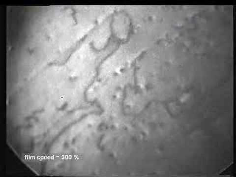 Dislocations in motion