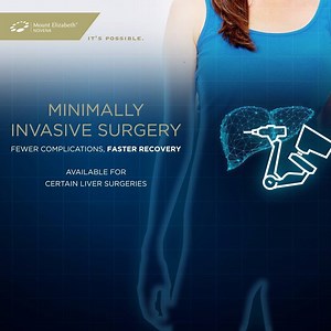 Forget lengthy recovery times and nasty scars. Minimally invasive surgery (MIS) uses robotic arms to make tiny incisions during liver surgery, reducing injury to the body.​ ​ Find out more: http://bit.ly/2CEAjyp #mountelizabethhospitals | Mount Elizabeth Novena Hospital