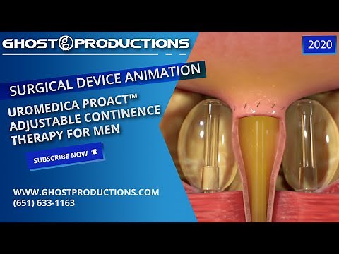 Medical Animation: Medical Device - Uromedica ProACT™ Adjustable Continence Therapy for Men
