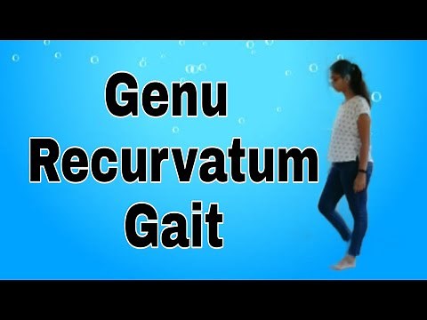 Genu Recurvatum Gait