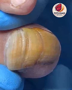 Safe Routines That Help Brittle Toenails Using Safe Home Products #SimpleHealthTricks #FootWellnessUSA #HealthyHabits #EverydayCare | Tots Mags Wheel