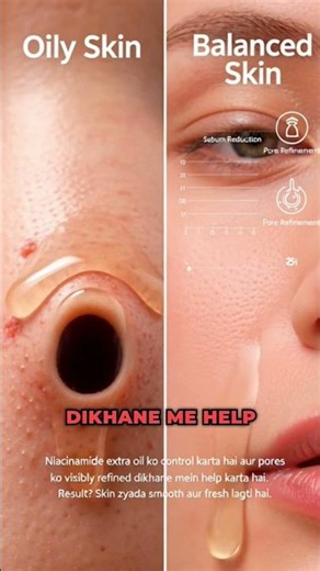 Niacinamide Serum: Hype Ya Real Results?Vitamin B3 Serum Ke Amazing Benefits! ✨