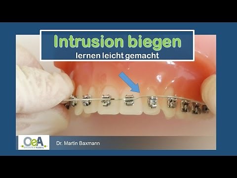 INTRUSIONSBIEGUNG - Zeit für die Biegeübung / INTRUSION STEP - time for wire bending I OeA
