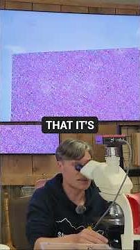 Frog Blood Under the Microscope