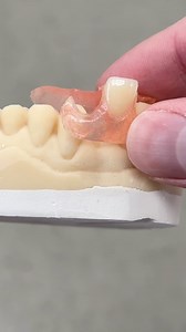 Lateral Flexi Nesbit Partial! Case from Dr. Morgan Johnson in Massachusetts! @_etec_ | CEO Luke Kahng