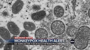 MONKEYPOX HEALTH ALERT: The CDC is warning doctors to be on the lookout for symptoms of monkeypox as health officials investigate a second possible infection in the U.S. amid dozens of global cases. Trevor Ault has more. https://abcn.ws/3wzwdEI | ABC World News Tonight with David Muir