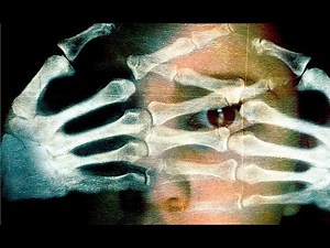 FRÁGILES (Trailer español)