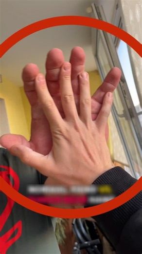 The 23-Year-Old Bodybuilder They Call the Human Bear