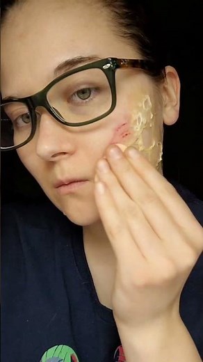 SFX makeup burns tutorial 💄 #makeup #makeuptutorial #sfx #sfxmakeup #tutorial