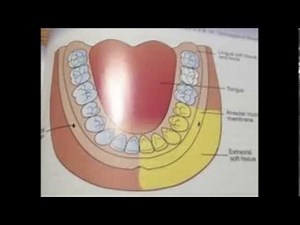 Incisive nerve block