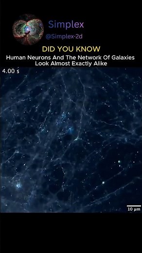 Is the Universe Just A Giant Brain?