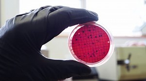 E Coli Growing On Dc Media Stock Footage Video (100% Royalty-free) 1087063700 | Shutterstock