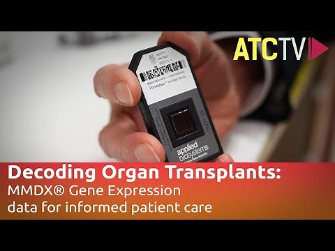 Decoding Organ Transplants: MMDx Gene Expression data for informed patient care