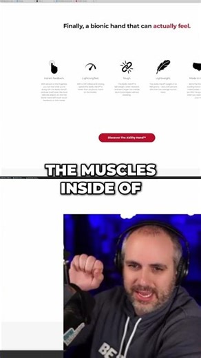 Ability Hand: Fastest Bionic Hand on The Market! #shorts